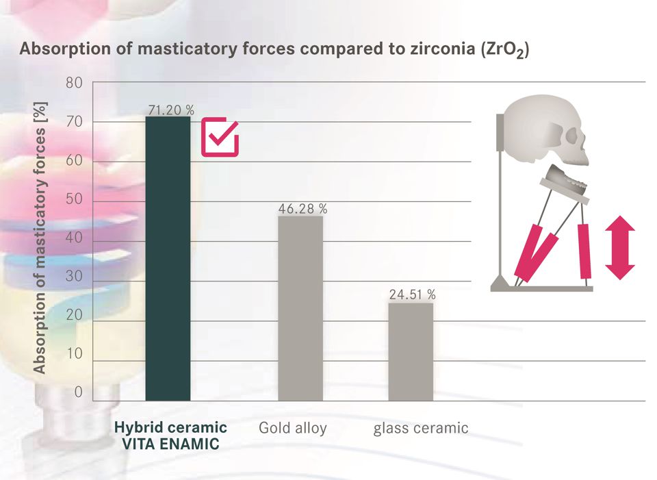 Source: University of Genoa, Department of fixed and implant restorations, Dr. Maria Menini et al., Genoa, Italy; 01/2015