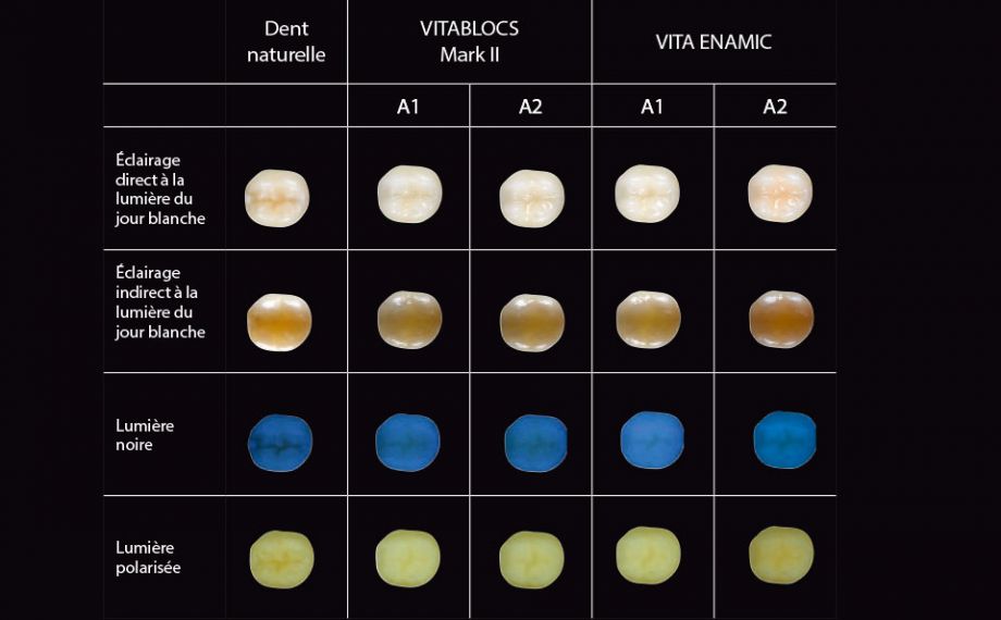 Ill. 2 : Photos montrant l'intégration optique de VITABLOCS et VITA ENAMIC sous différentes sources Conception de l'étude : Cette recherche était un projet commun du PD Dr Pascal Magne (Herman Ostrow School of Dentistry, USC, Los Angeles) et du PD Dr Jan-Frederik Güth (Poliklinik für Zahnärztliche Prothetik, LMU, Munich). L'objectif était d'analyser le comportement optique de restaurations partielles monolithiques identiques sur le plan géométrique en matériaux CFAO différents sur une dent de test naturelle afin de conseiller les praticiens en vue d'une intégration optique réussie. Dans ce but, six dentistes et six prothésistes ont évalué au vu de photos prises de manière standardisée 18 restaurations différentes sous diverses sources lumineuses.Source : PD Dr Jan-Frederik GüthCompte-rendu : Étude publiée en Int J Esthet Dent 2016 ; 11:394-409lumineuses sur une échelle de 1 (faible intégration optique) à 4 (restauration invisible).
Source header picture: Jorge Carro Juraez