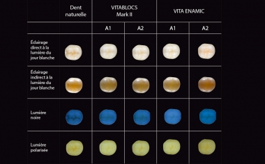 Ill. 2 : Photos montrant l'intégration optique de VITABLOCS et VITA ENAMIC sous différentes sources Conception de l'étude : Cette recherche était un projet commun du PD Dr Pascal Magne (Herman Ostrow School of Dentistry, USC, Los Angeles) et du PD Dr Jan-Frederik Güth (Poliklinik für Zahnärztliche Prothetik, LMU, Munich). L'objectif était d'analyser le comportement optique de restaurations partielles monolithiques identiques sur le plan géométrique en matériaux CFAO différents sur une dent de test naturelle afin de conseiller les praticiens en vue d'une intégration optique réussie. Dans ce but, six dentistes et six prothésistes ont évalué au vu de photos prises de manière standardisée 18 restaurations différentes sous diverses sources lumineuses.Source : PD Dr Jan-Frederik GüthCompte-rendu : Étude publiée en Int J Esthet Dent 2016 ; 11:394-409lumineuses sur une échelle de 1 (faible intégration optique) à 4 (restauration invisible).
Source header picture: Jorge Carro Juraez