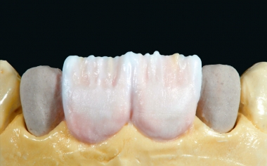 Ill. 10 : Ensuite, elle a été personnalisée avec du TRANS­LUCENT 5 (T5 : bleu clair) et du NECK 4 (N4 : orange).