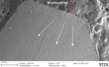 Abb. 1c: Detailansicht im REM zeigt den separierten Gerüstanteil als Bruchauslöser.