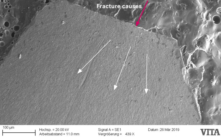 Fig. 1c: Detailed view in the SEM shows the separated portion of the framework as the cause of the fracture.