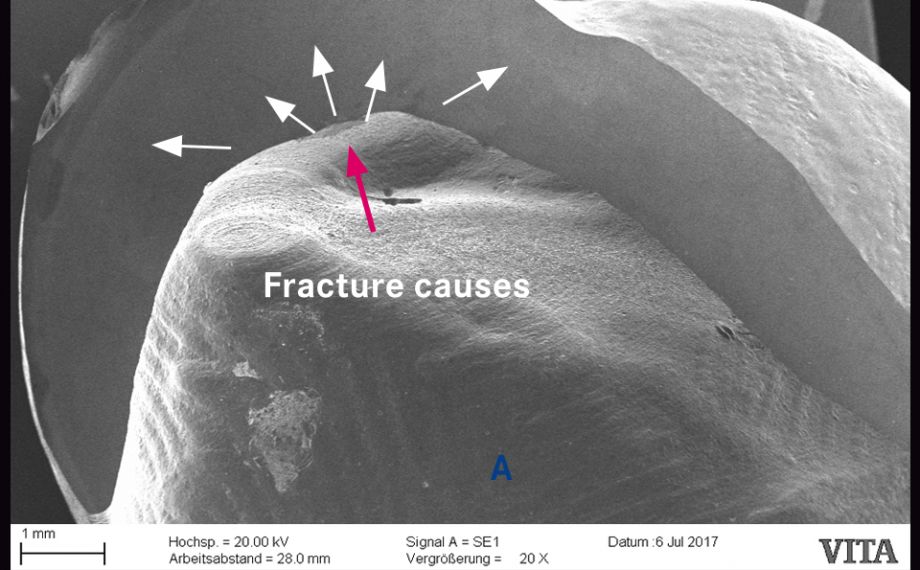 Fig. 2b: A ceramic pin “sintered” with the crown resulted in surface damage when the restoration was removed.