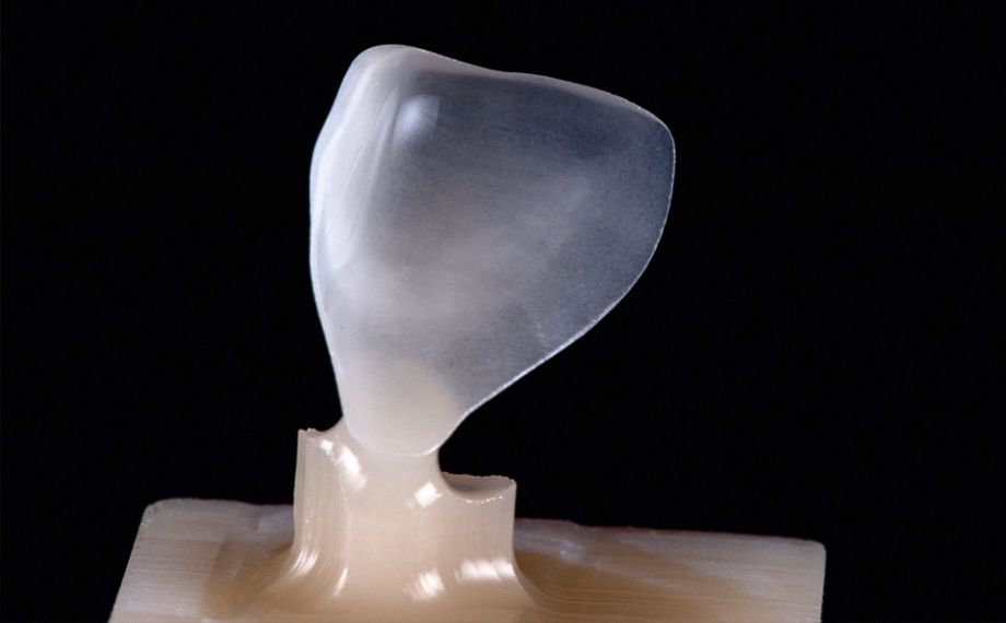 Fig. 3: The high-precision result after the grinding process with CEREC MC XL.