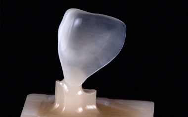 Fig. 3: The high-precision result after the grinding process with CEREC MC XL.