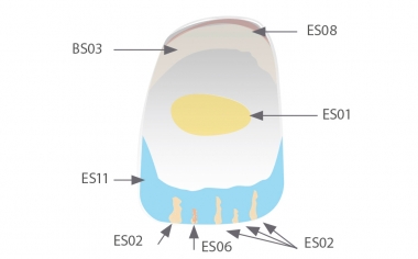 Fig. 10: Characterization was done using the stain system VITA AKZENT Plus.