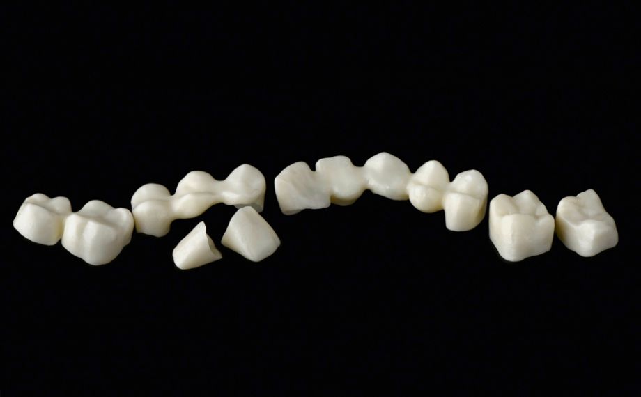 Fig. 3: The zirconia substructures with an anatomically reduced design.