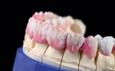 Fig. 6: Layering with EFFECT ENAMEL 11, MAMELON 2/3 and EFFECT ENAMEL 1.