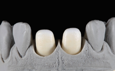 Fig. 2: For the washbake, CHROMA STAINS A was applied and dusted with yellowish EFFECT LINER 4.