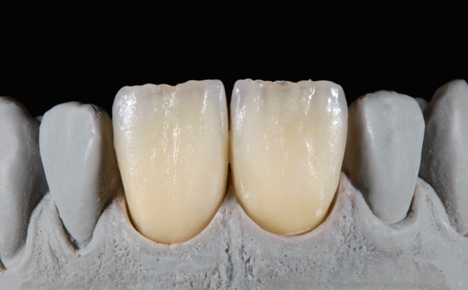 Fig. 10: The interplay between intense shades, fluorescent effects and translucency after firing.