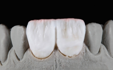 Fig. 11: Layering of EO1, NEUTRAL and WINDOW on the entire surface and characterizations with EFFECT PEARL 1.