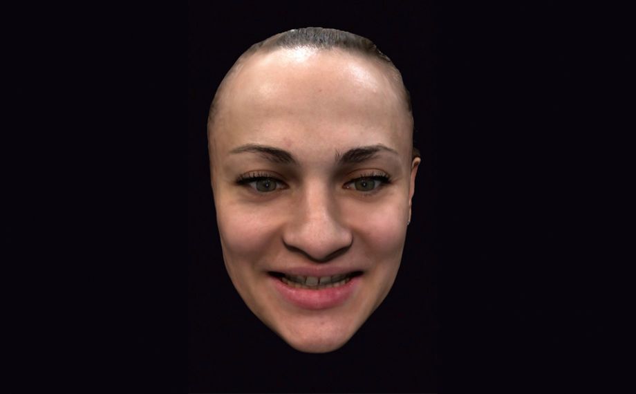 Fig. 2 : Le scannage du visage avec l‘application a permis une première planification virtuelle avec la patiente.