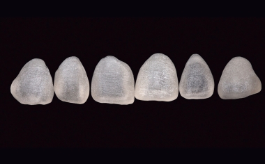 Fig. 11 : La céramique de silicate de lithium dopée au dioxyde de zirconium VITA SUPRINITY PC autorise un meulage très précis grâce à sa fine granularité.