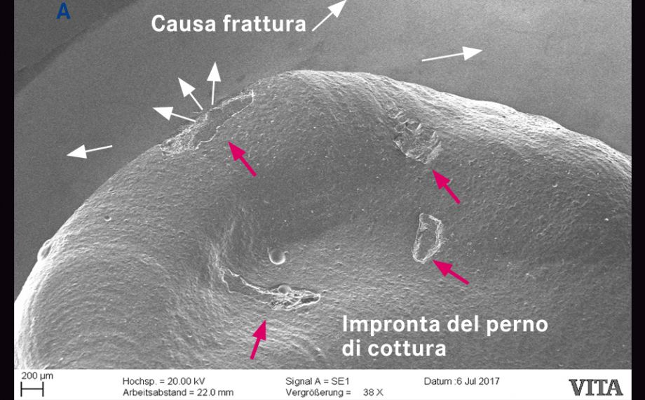 Fig. 2c: Un’immagine dettagliata al SEM mostra l’impronta del perno di cottura come pure la causa della frattura.