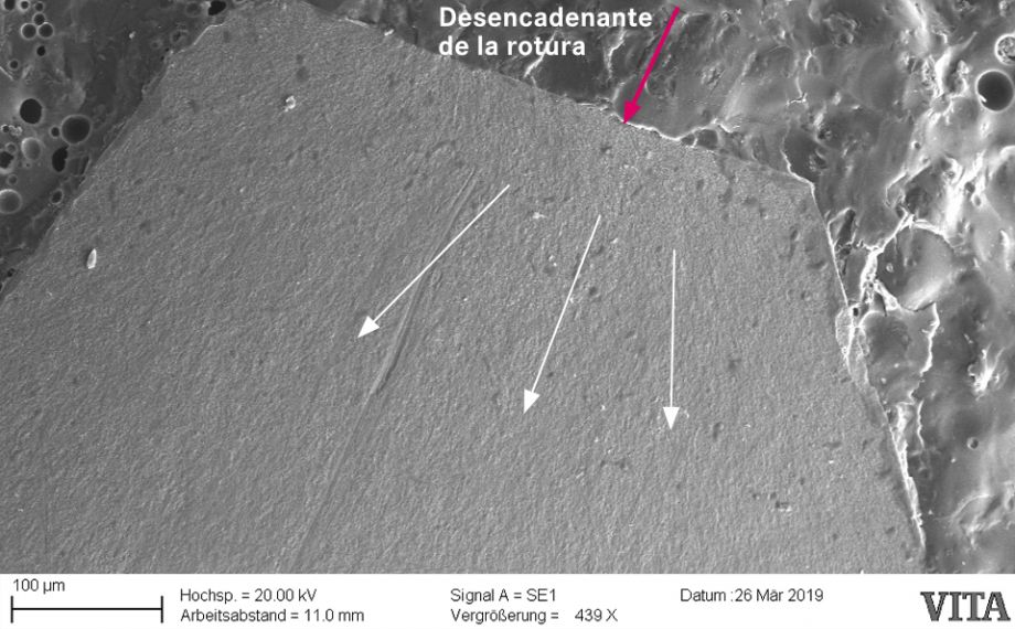 Fig. 1c: La vista detallada en el MEB muestra la parte separada de la estructura como desencadenante de la rotura. 