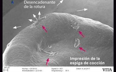 Fig. 2c: La vista detallada en el MEB muestra la impresión de la espiga de cocción y el desencadenante de la rotura.