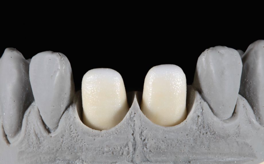 Fig. 2: Para la cocción wash se aplicó CHROMA STAINS A y se espolvoreó EFFECT LINER 4 amarillento.