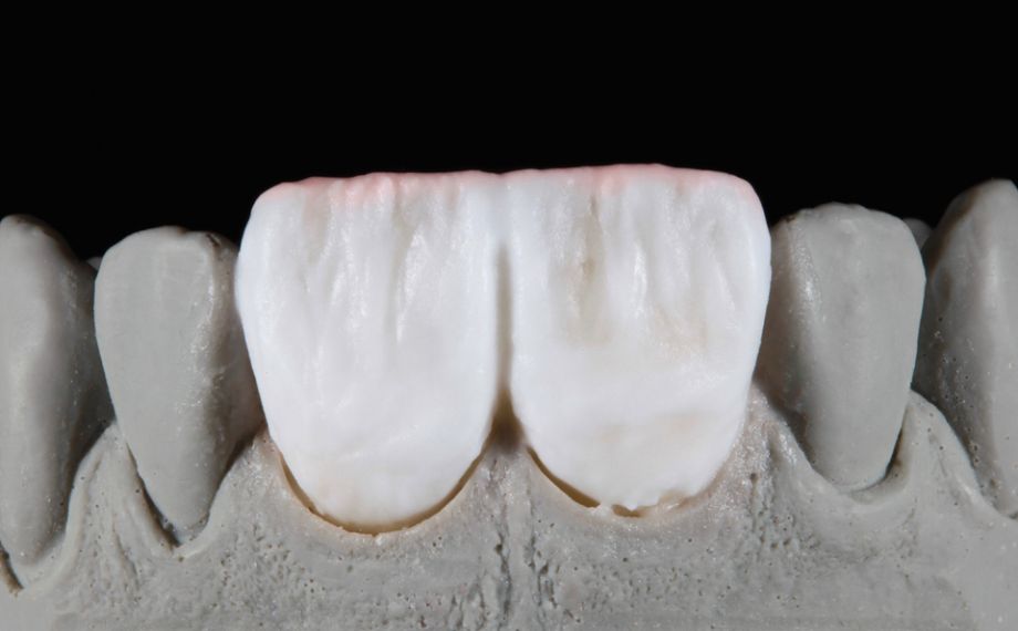 Fig. 11: Estratificación con EO1, NEUTRAL y WINDOW en toda la superficie y caracterizaciones con EFFECT PEARL 1.