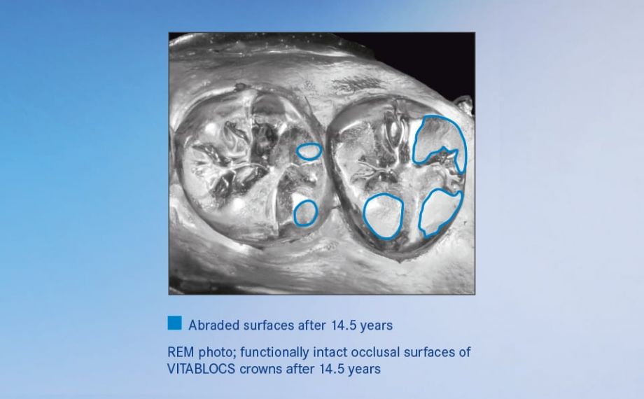 Graphic 2 Studies showed that restorations made of VITABLOCS exhibit abrasion behavior similar to nature.Source External study 2016, University of Zurich/ practice am Zürichberg, Epoxy model of impression after 14.5 years, vapor-plated with gold, b/w photo of the model (PD Dr. Andreas Bindl)