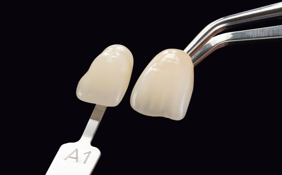 Fig 2a-b Sample representation of the visual inspection of the shade fidelity of a VITA LUMEX AC sample crown to the VITA shade standard, and for the implementation of a shade formula using ceramic powders mixed with color pigments.
