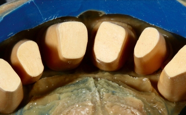 Fig. 2 Production of the master model.