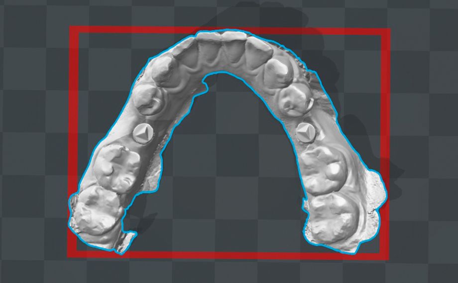 Fig. 4 The virtual model of the lower jaw was used as the basis for the production of a control model using additive manufacturing.