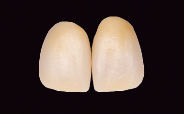 Fig. 14 The results immediately after sintering in VITA ZYRCOMAT 6100 MS.