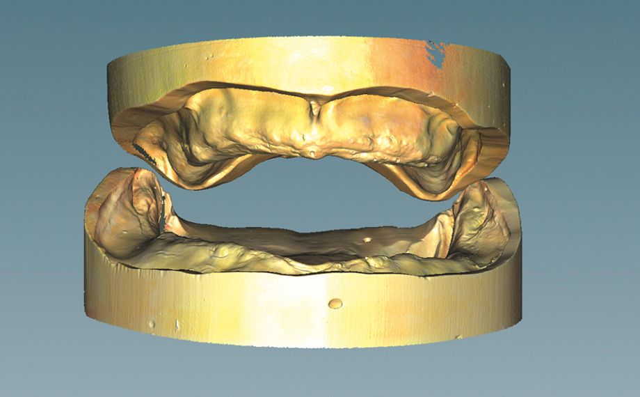 Fig. 2 The scan of the two working models in relation to the jaws, according to the axis relationship in the articulator.