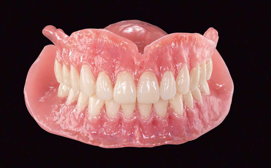 Fig. 12 The completed total dentures after finishing, polishing and individualization of the lip shield using VITA VM LC flow.