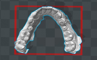 Fig. 4 El modelo virtual del maxilar inferior fue la base para la confección aditiva de un modelo de control.