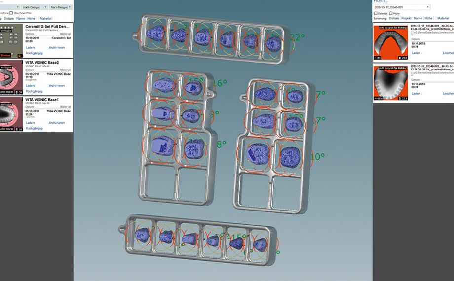 Fig. 9 Los VITA VIONIC DD FRAMES en el software CAD antes de la modificación CAD circular-basal de los dientes protésicos.