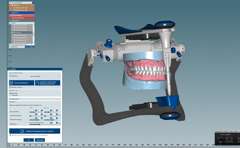 Ill. 8 Dans l’articulateur virtuel, l’occlusion dynamique a ensuite été contrôlée.