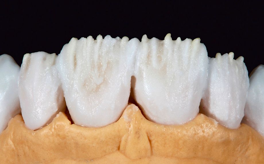 Fig. 5 I mammelloni sono stati ulteriormente accentuati con MAMELON saffron