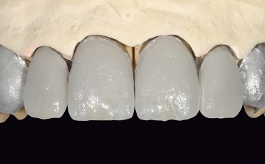 Fig. 13 Risultato della stratificazione dopo la cottura.