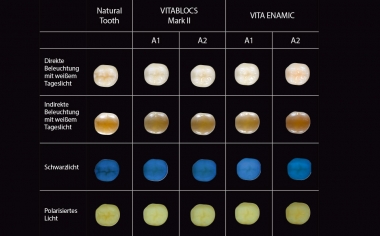 Abb. 2: Fotoaufnahmen zur lichtoptischen Integration von VITABLOCS und VITA ENAMIC unter den verschiedenen Lichtquellen.Studiendesign: Diese Untersuchung war ein Gemeinschaftsprojekt von PD Dr. Pascal Magne (Herman Ostrow School of Dentistry, USC, Los Angeles) und PD Dr. Jan-Frederik Güth (Poliklinik für Zahnärztliche Prothetik, LMU, München). Ziel war es, das lichtoptische Verhalten geometrisch identischer, monolithischer Teilrestaurationen aus verschiedenen CAD/CAM-Materialien auf einem natürlichen Testzahn zu untersuchen, um Praktikern Hinweise für eine erfolgreiche optische Integration zu geben. Je 6 Zahnärzte und Zahntechniker bewerteten dafür auf standardisiert aufgenommenen Fotografien 18 verschiedene Restaurationen auf einer Skala von 1 (geringe optische Integration) bis 4 (Restauration nicht sichtbar) unter verschiedenen Lichtquellen.Quelle: PD Dr. Jan-Frederik GüthBericht: Studie publiziert in Int J Esthet Dent 2016; 11:394-409.
Quelle Kopfbild: Jorge Carro Juraez