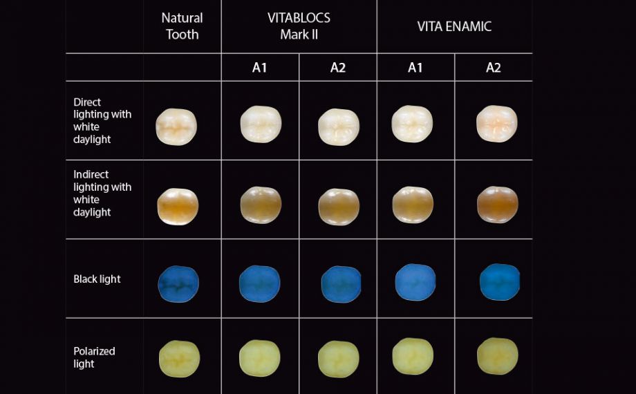 Fig. 2: Photographs of photo-optical integration of VITABLOCS and VITA ENAMIC under various light sources.Study design: This study was a joint project between PD Dr. Pascal Magne (Herman Ostrow School of Dentistry, USC, Los Angeles) and PD Dr. Jan-Frederik Güth (Poliklinik für Zahnärztliche Prothetik, LMU, Munich). The aim was to examine the photo-optical behavior of geometrically identical, monolithic partial restorations from different CAD/CAM materials on a natural test tooth in order to provide practitioners with tips for achieving successful optical integrations. Six dentists and six dental technicians rated standardized restorations on 18 different restorations on a scale from 1 (low optical integration) to 4 (restoration not visible) under different light sources.Source: PD Dr. Jan-Frederik GüthReport: Study published in the Int J Esthet Dent 2016; 11:394-409.
Source header picture: Jorge Carro Juraez

