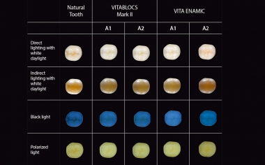 Fig. 2: Photographs of photo-optical integration of VITABLOCS and VITA ENAMIC under various light sources.Study design: This study was a joint project between PD Dr. Pascal Magne (Herman Ostrow School of Dentistry, USC, Los Angeles) and PD Dr. Jan-Frederik Güth (Poliklinik für Zahnärztliche Prothetik, LMU, Munich). The aim was to examine the photo-optical behavior of geometrically identical, monolithic partial restorations from different CAD/CAM materials on a natural test tooth in order to provide practitioners with tips for achieving successful optical integrations. Six dentists and six dental technicians rated standardized restorations on 18 different restorations on a scale from 1 (low optical integration) to 4 (restoration not visible) under different light sources.Source: PD Dr. Jan-Frederik GüthReport: Study published in the Int J Esthet Dent 2016; 11:394-409.
Source header picture: Jorge Carro Juraez

