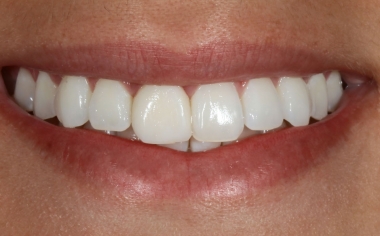 Fig. 1: The initial situation with morphological deficits and asymmetries in the esthetic zone.